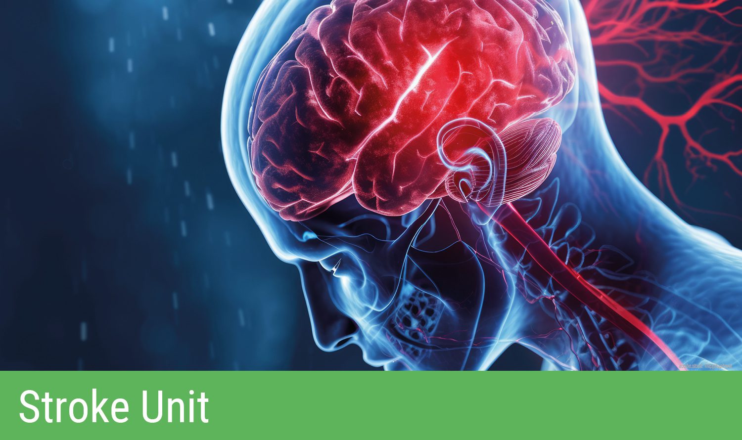 iluminierte Holographisches 3D-Modell des menschlichen Kopfbereiches, insbesondere des Gehirns. Grüner Balken am unteren Bildrand mit Aufschrift Stroke Unit.